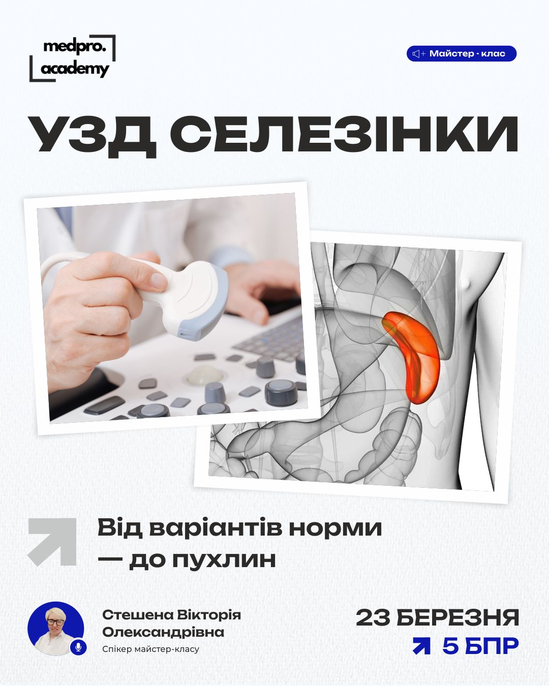 3УЗД селезінки